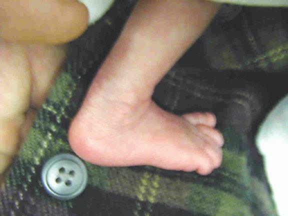 D23e footbutton2 copy